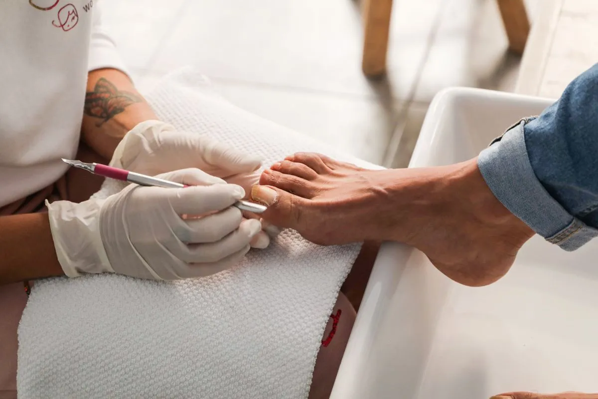 Fodterapeut behandler en tånegl med steriliseret instrument